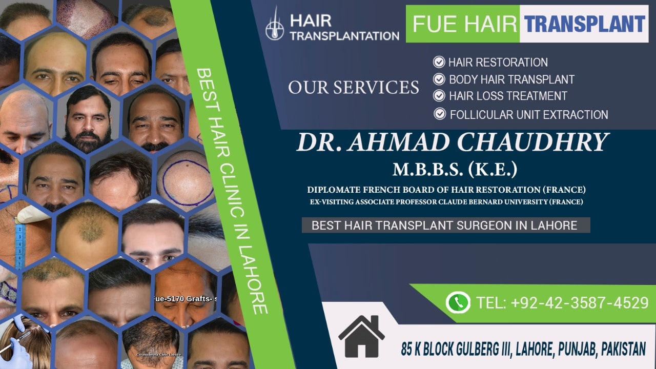 FUE hair transplant clinic Lahore Pakistan Free checkup Cosmoderma