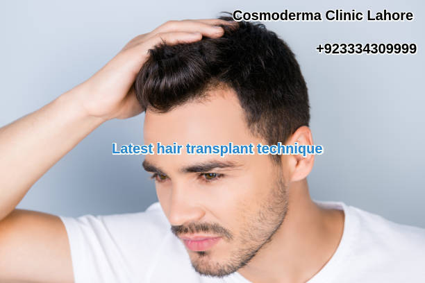 Hair restoration surgery clinic Lahore Pakistan | Free consultation | call  us