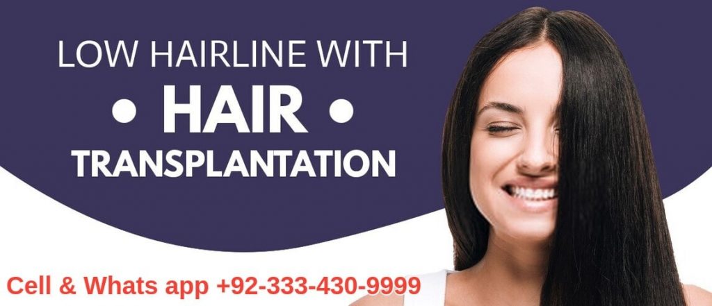 Hairline hair transplant Lahore Pakistan