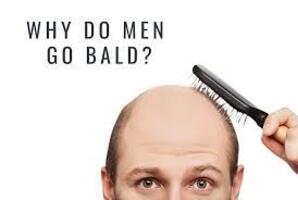 Why do men go bald