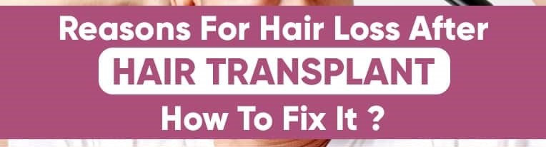 hair loss after hair transplant