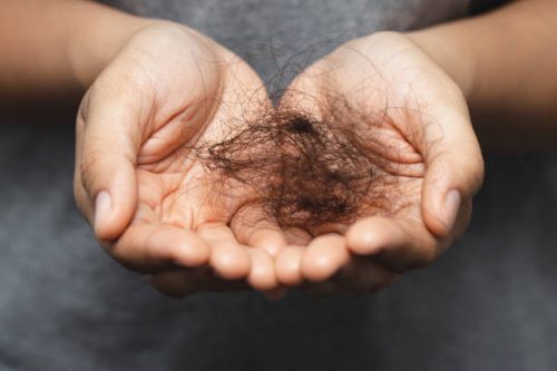 Female hair Loss treatment really effective