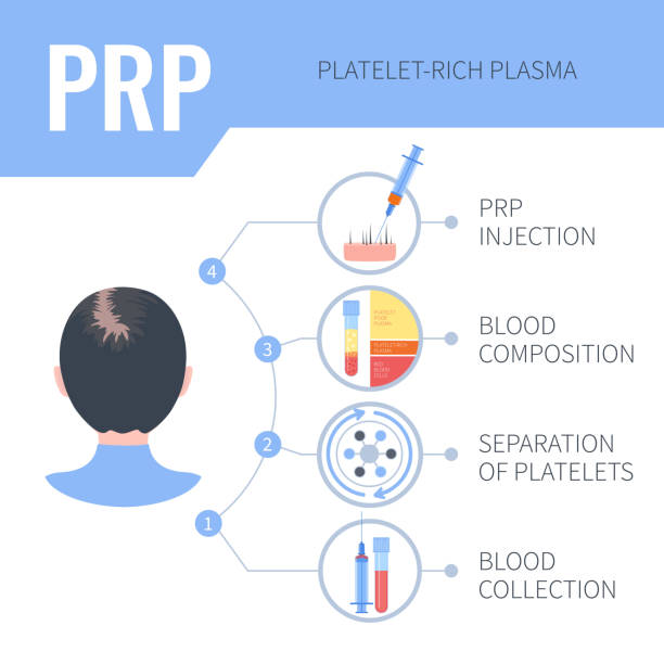 Basic technique Platelet rich plasma