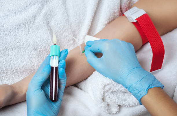 Blood from arm for platelet rich plasma preparation