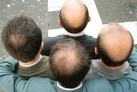 baldness genetic prediction