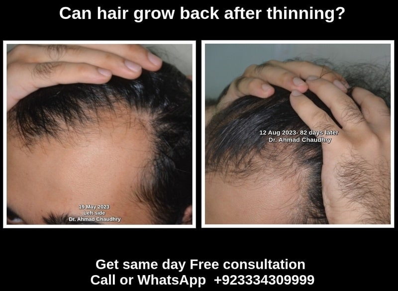 Best treatment hair growth